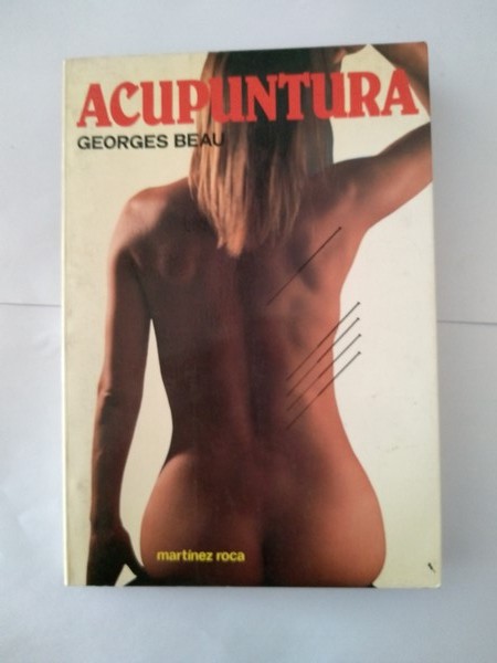 Acupuntura