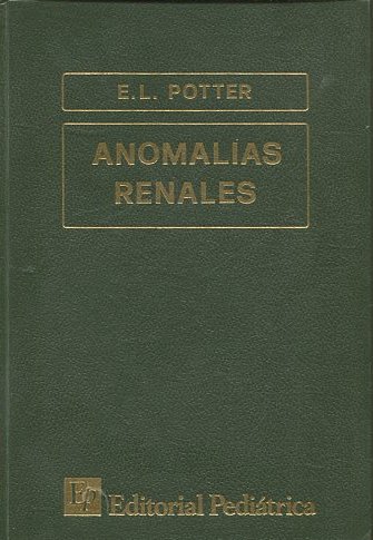 ANOMALIAS RENALES.