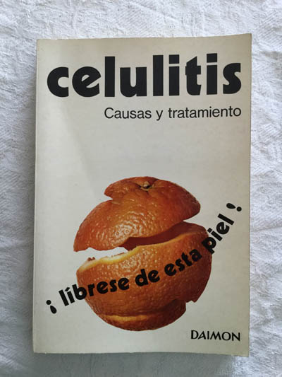 Celulitis. Causas y tratamiento