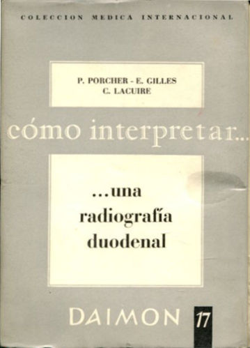 COMO INTERPRETAR...UNA RADIOGRAFIA GASTRODUODENAL.