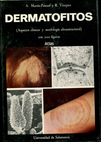 DERMATOFITOS. ASPECTOS CLINICOS Y MORFOLOGIA  ULTRAESTRUCTURAL.