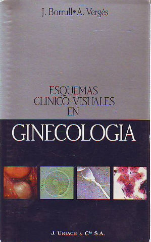 ESQUEMAS CLINICO-VISUALES EN GINECOLOGIA.