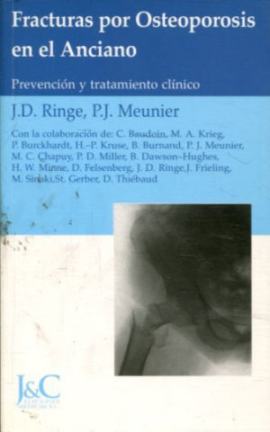 FRACTURAS POR OSTEOPOROSIS EN EL ANCIANO. PREVENCION Y TRATAMIENTO CLINICO.