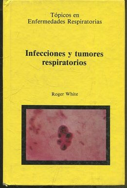 INFECCIONES Y TUMORES RESPIRATORIOS.