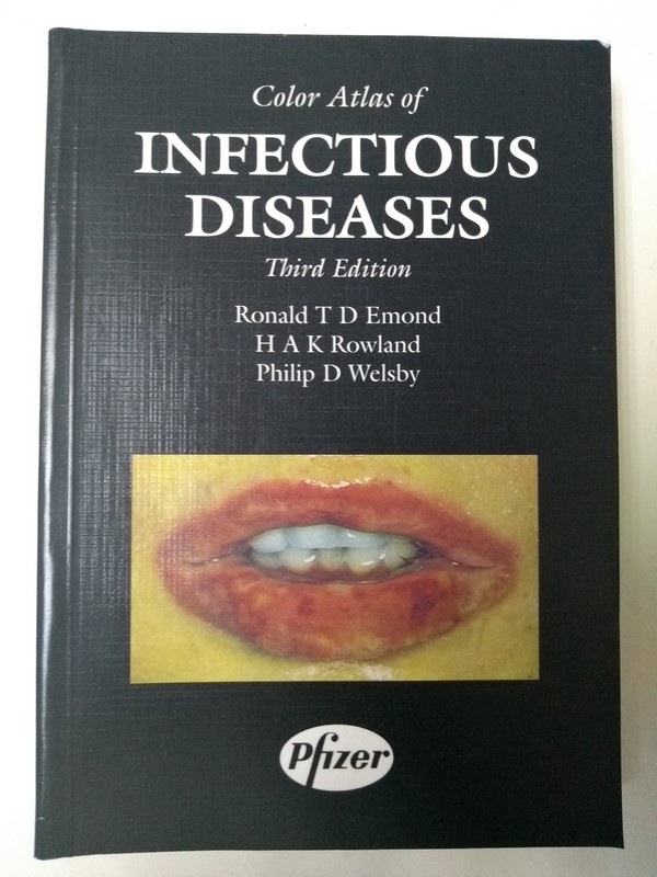 Infectious diseases