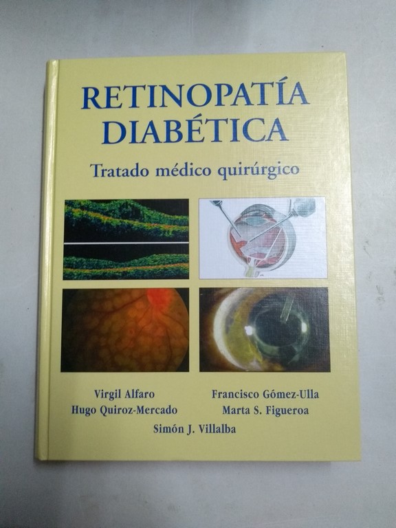 Retinopatía diabética. Tratamiento médico quirúrgico